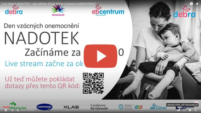 Den vzacných on_streem